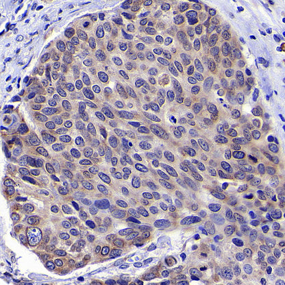 CCDC47 Recombinant Rabbit mAb (S-4158-17)