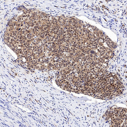 Caspase-3 Recombinant Rabbit mAb (S-656-43)