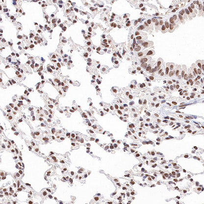 E2F4 Recombinant Rabbit mAb (S-586-214)
