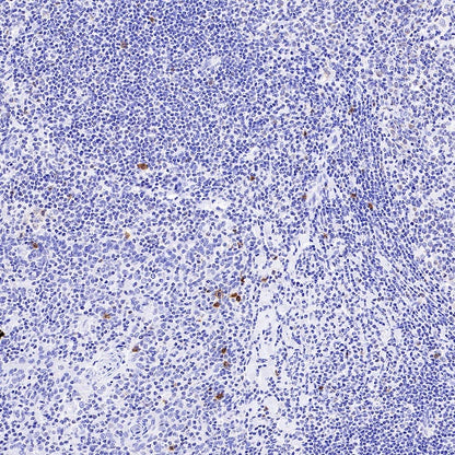 CD94 Recombinant Rabbit mAb (S-2616-5)