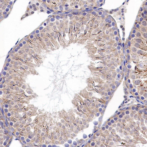 Trim30a Recombinant Rabbit mAb (S-1753-35)