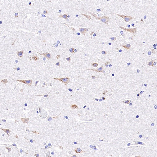 M6PR Recombinant Rabbit mAb (S-2348-14)