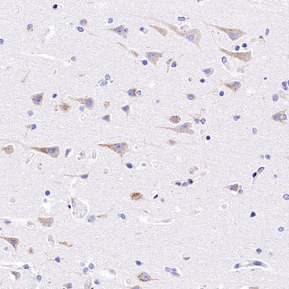 M6PR Recombinant Rabbit mAb (S-2348-14)