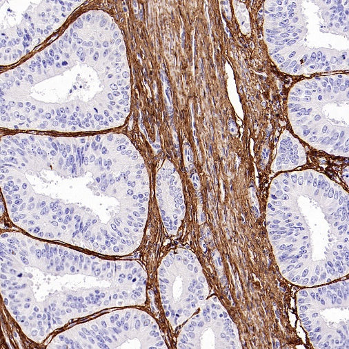 COL1A1 Recombinant Rabbit mAb (S-2975-9)