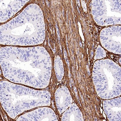COL1A1 Recombinant Rabbit mAb (S-2975-9)
