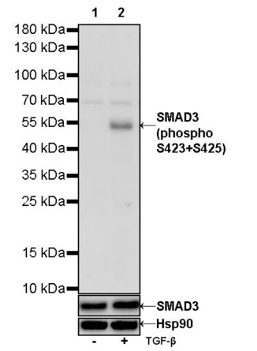 SMAD3 (phospho S423+S425) Recombinant Rabbit mAb (S-541-321)