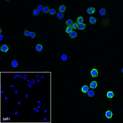 Mouse Anti-Human CD11a Antibody