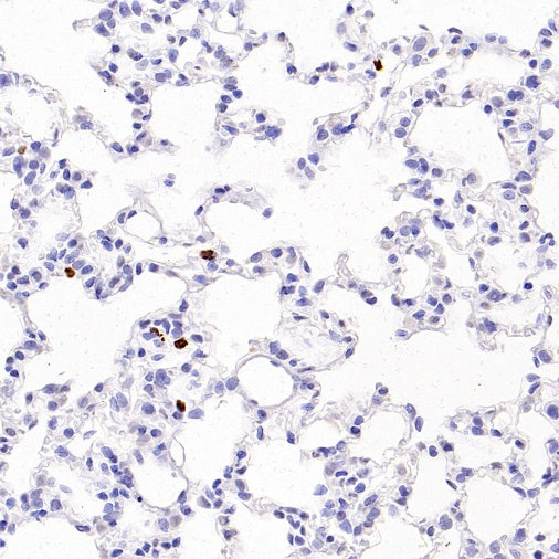 PAD4 Recombinant Rabbit mAb (SDT-2416-3)