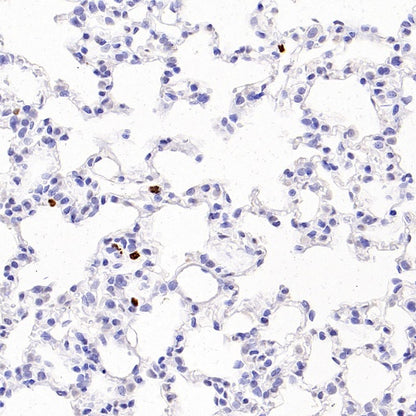 PAD4 Recombinant Rabbit mAb (SDT-2416-3)