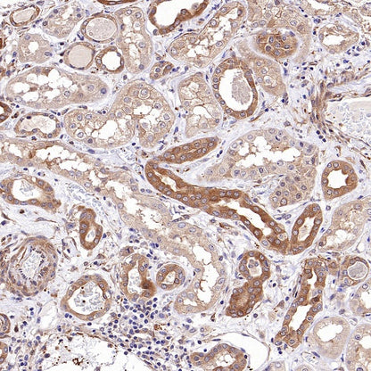 Vinculin Recombinant Mouse mAb (S-916-217)