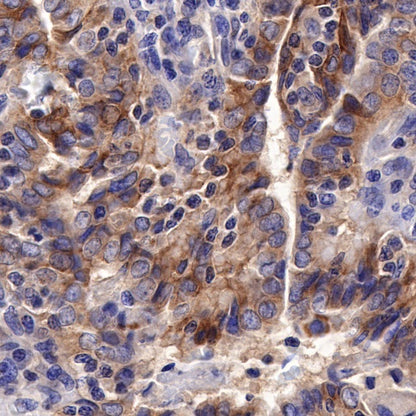 TWEAKR/FN14 Recombinant Rabbit mAb (S-913-1)