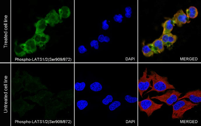 Phospho-LATS1/2(Ser909/872) Recombinant Rabbit mAb (S-1874-69)