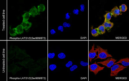 Phospho-LATS1/2(Ser909/872) Recombinant Rabbit mAb (S-1874-69)