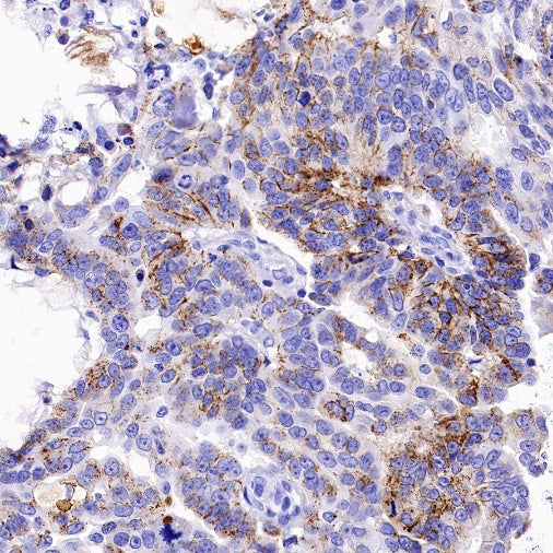 Claudin 3+Claudin 9 Recombinant Rabbit mAb (SDT-1452-80)