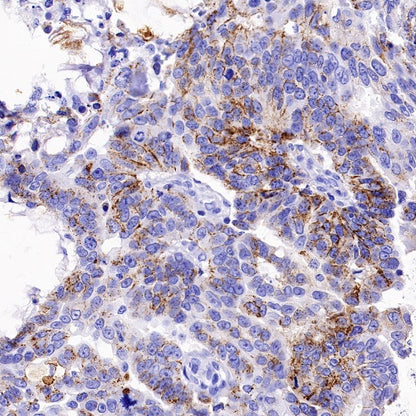 Claudin 3+Claudin 9 Recombinant Rabbit mAb (SDT-1452-80)