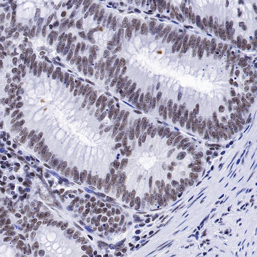 PIAS1 Recombinant Rabbit mAb (S-1430-7)