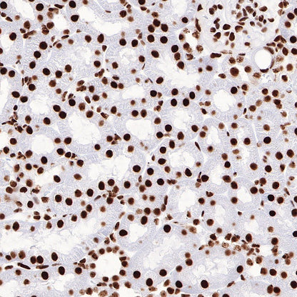 ILF3 Recombinant Rabbit mAb (S-R342)