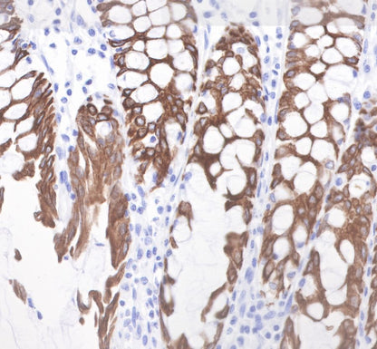 Cytokeratin 19 Recombinant Rabbit  mAb,PBS Only (SDT-107-19)