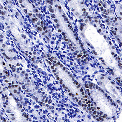 FOXA2 Recombinant Rabbit mAb (SDT-R174)