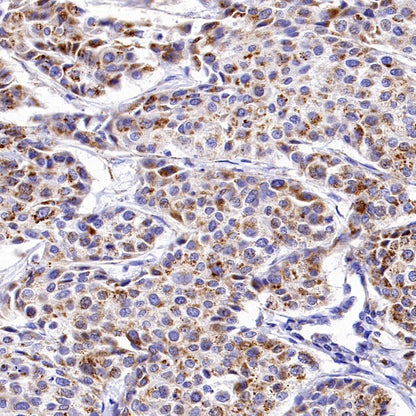 GLS1 Recombinant Rabbit mAb (S-2355-20)