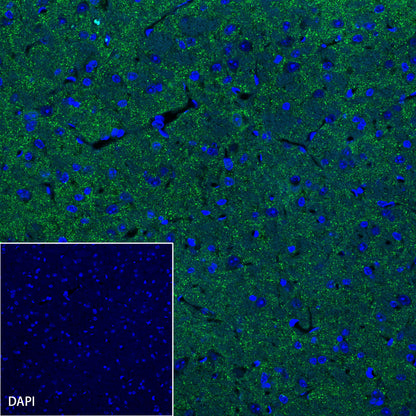 α-Synuclein Recombinant Rabbit mAb (S-441-86)