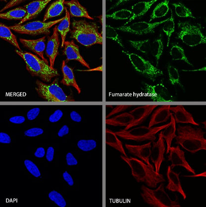 Fumarate hydratase Recombinant Rabbit mAb (SDT-2434-37)