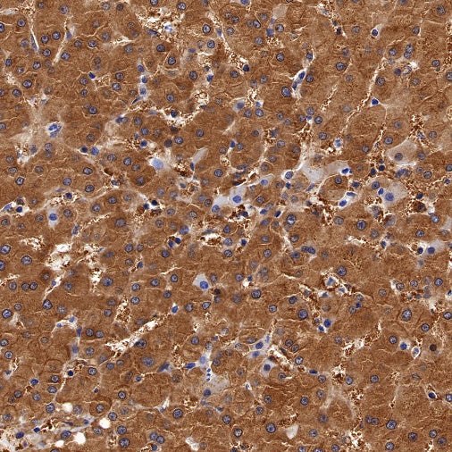 Peroxiredoxin 1/PAG Recombinant Rabbit mAb (S-1673-22)