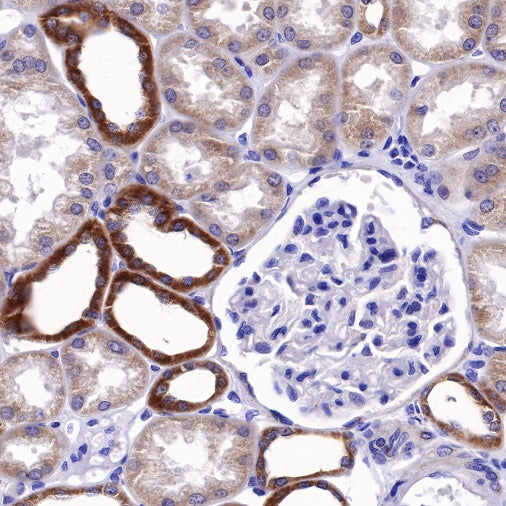 Bcl-xL Recombinant Rabbit mAb (S-487-28)