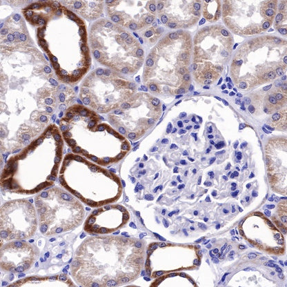 Bcl-xL Recombinant Rabbit mAb (S-487-28)