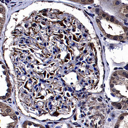 VEGFA Recombinant Rabbit mAb (S-5301)