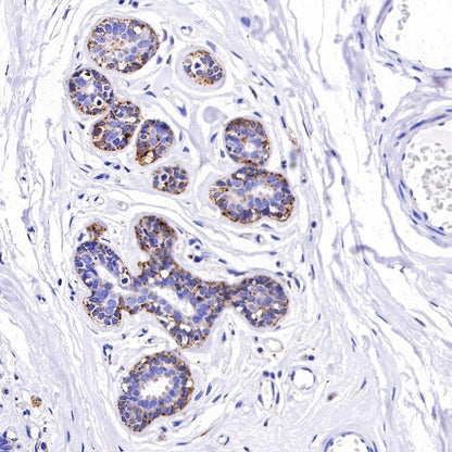 Cathepsin D Recombinant Rabbit mAb (S-R208)