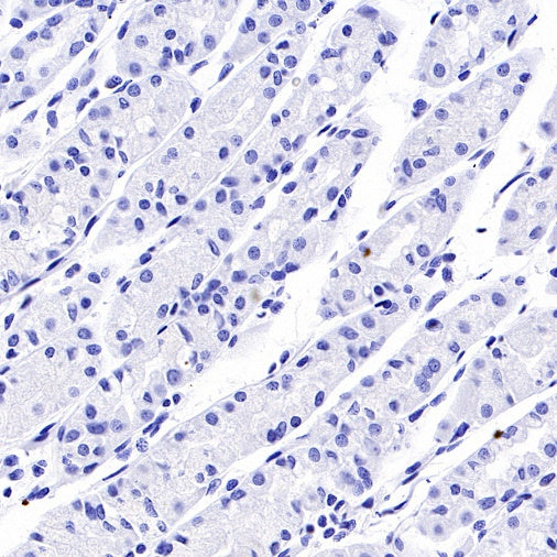 PTH Recombinant Rabbit mAb (S-539-28)