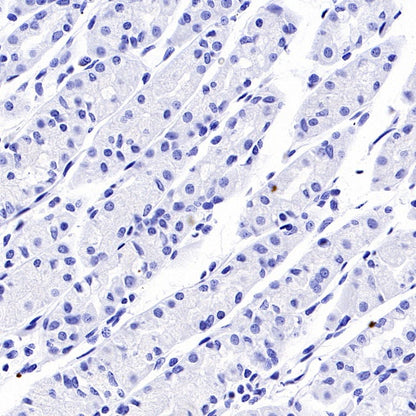 PTH Recombinant Rabbit mAb (S-539-28)