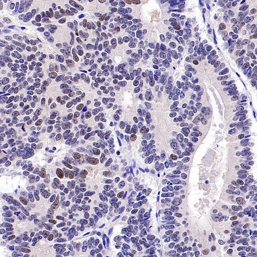 KDM4A Recombinant Rabbit mAb (S-957-138)