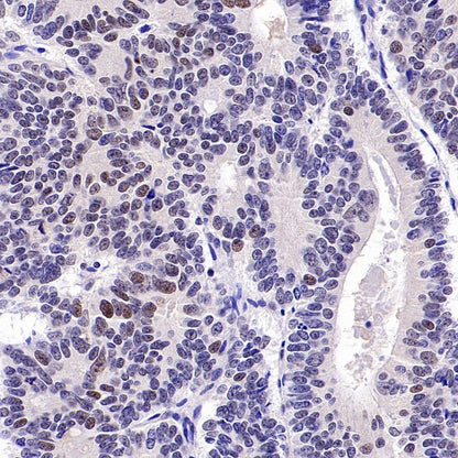 KDM4A Recombinant Rabbit mAb (S-957-138)