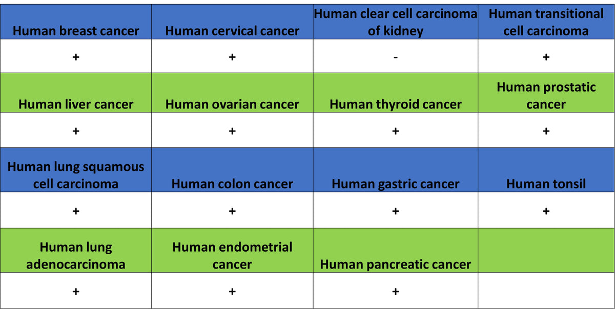 PTK7 Recombinant Rabbit mAb (SDT-2432-156)