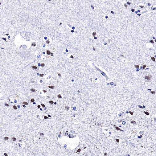 U2AF2 Recombinant Rabbit mAb (S-1324-66)