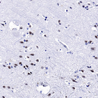 U2AF2 Recombinant Rabbit mAb (S-1324-66)