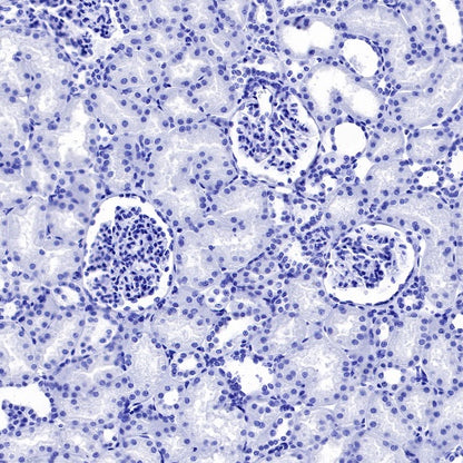 Neurofilament H Recombinant Rabbit mAb (S-532-103)