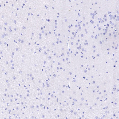 DAZL Recombinant Rabbit mAb (S-1552-6)