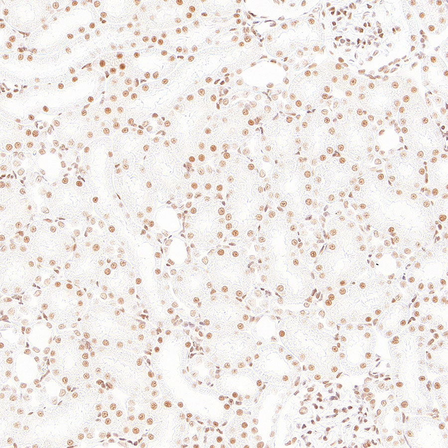 RAD21 Recombinant Rabbit mAb (S-4271-136)