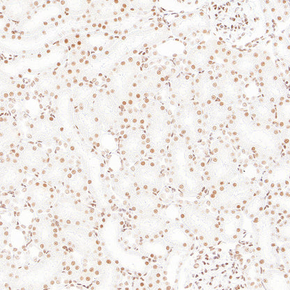 RAD21 Recombinant Rabbit mAb (S-4271-136)