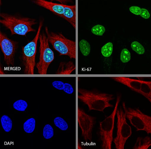 S-RMab® Ki67 Recombinant Rabbit mAb (SDT-R459)