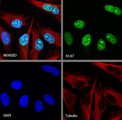 S-RMab® Ki67 Recombinant Rabbit mAb (SDT-R459)
