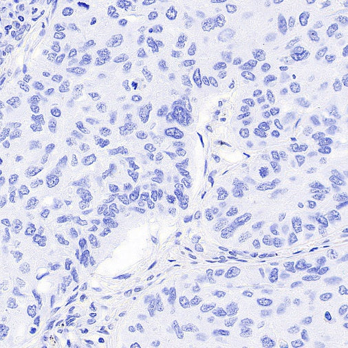 Histone H3.3 G34W Recombinant Rabbit mAb (SDT-6018)