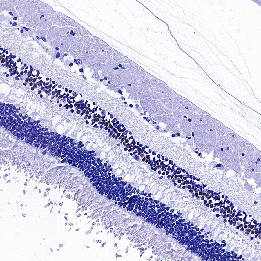 CHX10 Recombinant Rabbit mAb (S-3940-13)