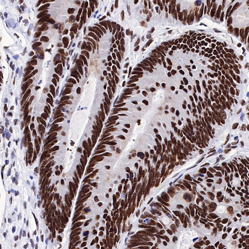 Dnmt1 Recombinant Rabbit mAb (S-R324)