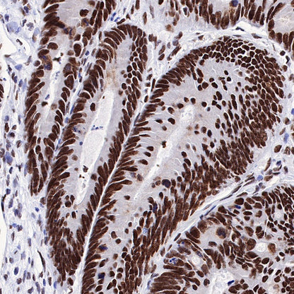 Dnmt1 Recombinant Rabbit mAb (S-R324)