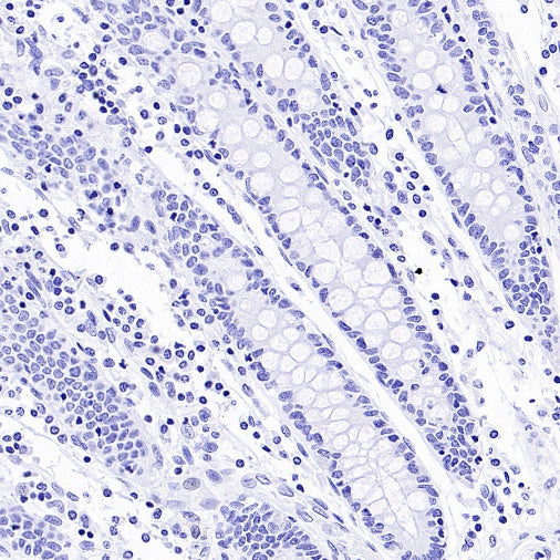 AKAP4 Recombinant Rabbit mAb (SDT-4196)