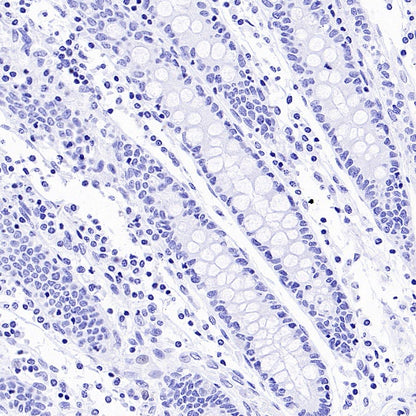 AKAP4 Recombinant Rabbit mAb (SDT-4196)